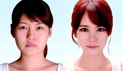 韩国明星眼鼻整形专家黄贵焕明日访问悦好