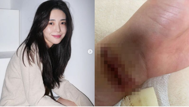 权珉娥