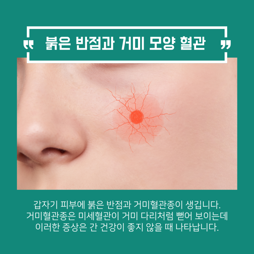 231017_한망_20231024_103203_3